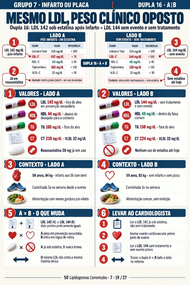 Página 19 de +50 Lipidogramas Reais Comentados Lado a Lado (de 27)